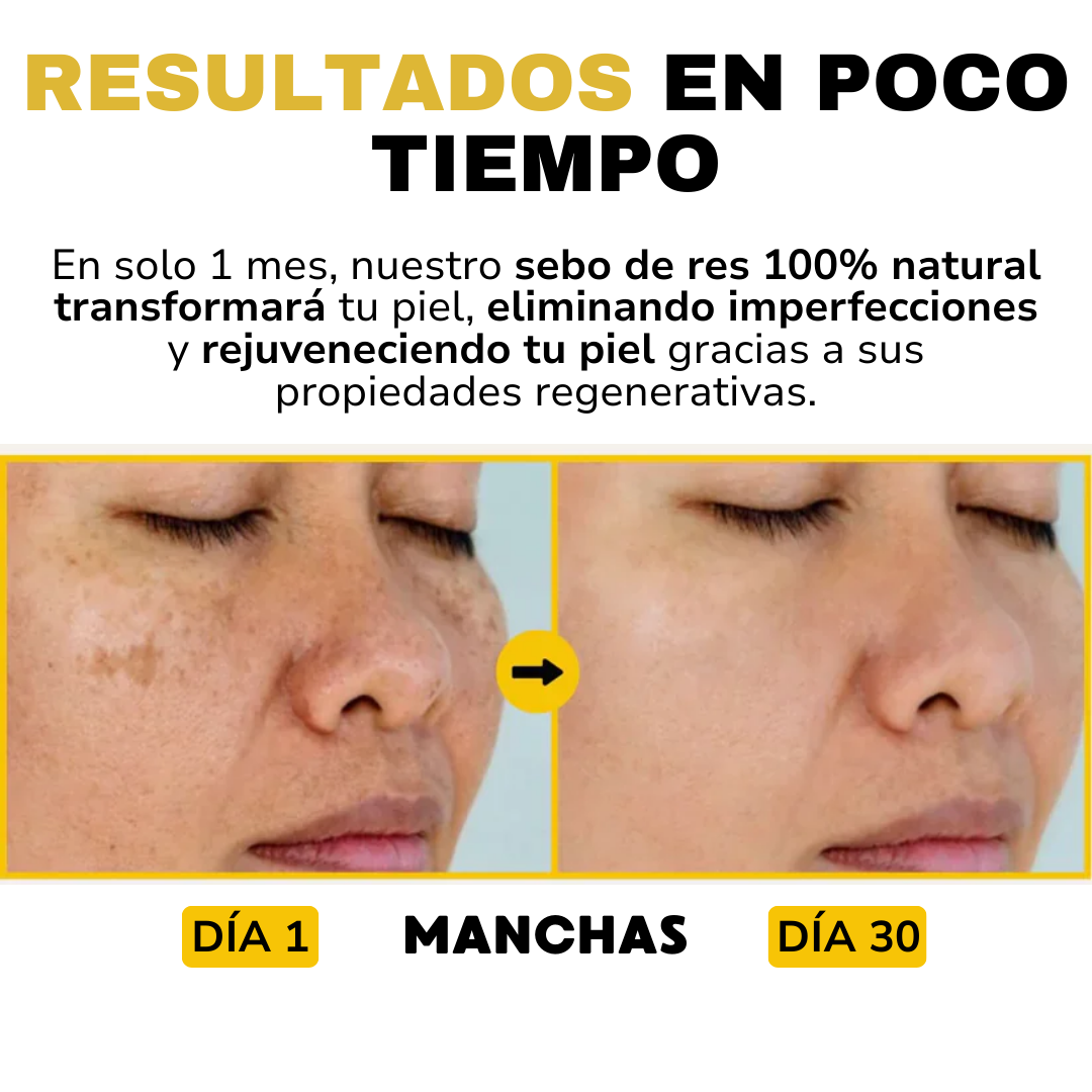 SEBO DE RES - Evil goods