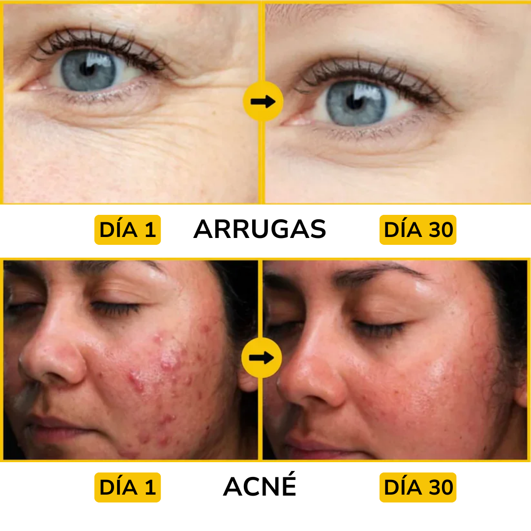 SEBO DE RES - Evil goods